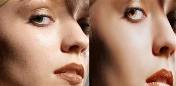 微晶磨皮<a href=http://www.f3bb6.cn/listinfo-782-0.html target=_blank class=infotextkey>去眼角細紋</a>治療方式是什么？