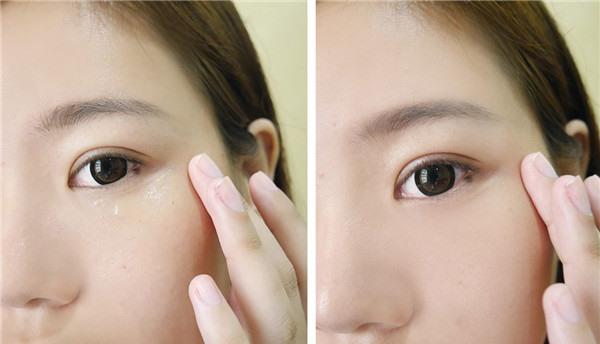 <a href=http://www.f3bb6.cn/listinfo-613-0.html target=_blank class=infotextkey>射頻</a><a href=http://www.f3bb6.cn/listinfo-768-0.html target=_blank class=infotextkey>微針</a><a href=http://www.f3bb6.cn/listinfo-782-0.html target=_blank class=infotextkey>去眼角細(xì)紋</a>多少錢？