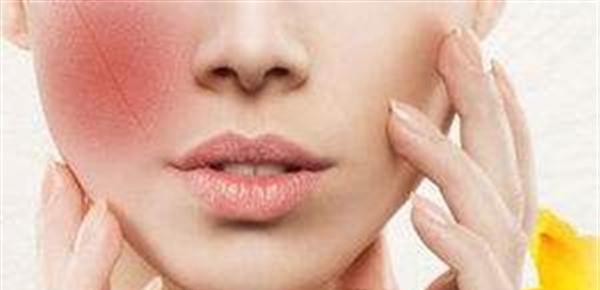 面部紅血絲怎么去除