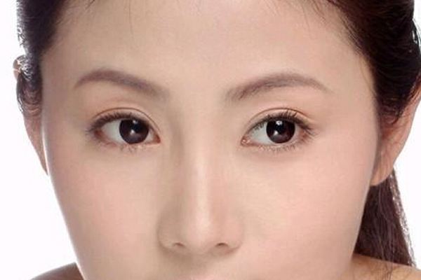 做<a href=http://www.f3bb6.cn/listinfo-724-0.html target=_blank class=infotextkey>雙眼皮</a>重瞼術有什么危害 重瞼術有哪些治療方法