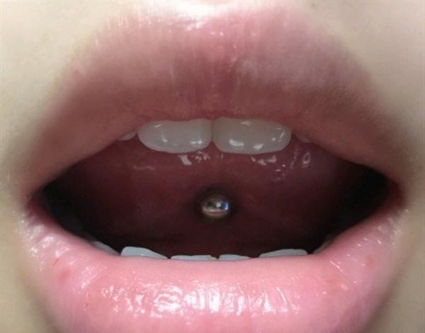 舌釘幾天不戴會(huì)長(zhǎng)死 舌釘不帶了洞會(huì)自己愈合嗎