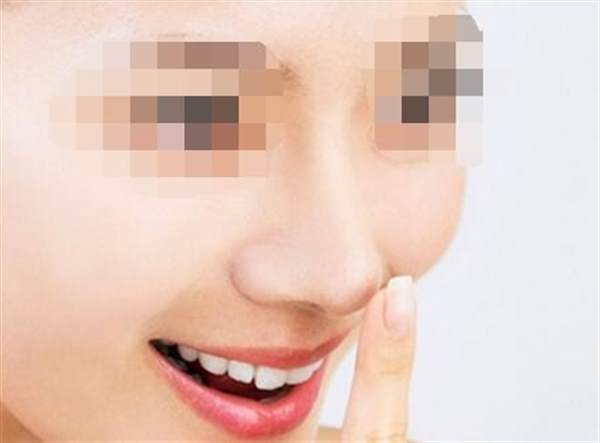 自體脂肪<a href=http://www.f3bb6.cn/listinfo-737-0.html target=_blank class=infotextkey>隆鼻</a>的缺點(diǎn)有哪些