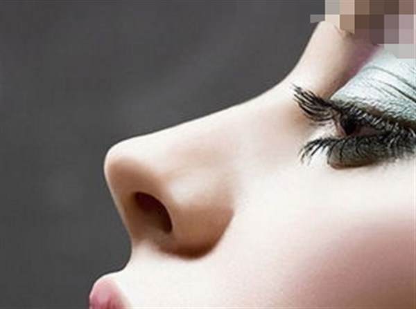 自體脂肪<a href=http://www.f3bb6.cn/listinfo-737-0.html target=_blank class=infotextkey>隆鼻</a>案例分享