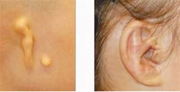 成都全<a href=http://www.f3bb6.cn/listinfo-699-0.html target=_blank class=infotextkey>耳再造</a>修復的價格是多少