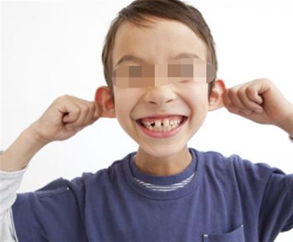 北京<a href=http://www.f3bb6.cn/listinfo-692-0.html target=_blank class=infotextkey>耳部整形</a>費(fèi)用