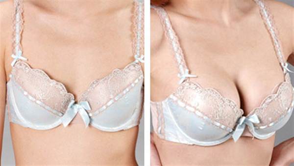 注射<a href=http://www.f3bb6.cn/listinfo-618-0.html target=_blank class=infotextkey>隆胸</a>術的價格