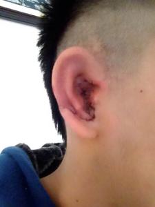 珠海全<a href=http://www.f3bb6.cn/listinfo-699-0.html target=_blank class=infotextkey>耳再造</a>修復的價格是多少