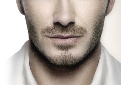 解析:無痕胡須種植術的優點
