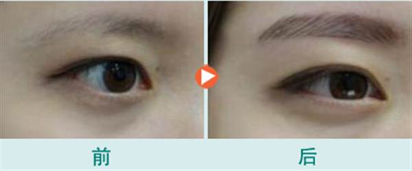 <a href=http://www.f3bb6.cn/listinfo-657-0.html target=_blank class=infotextkey>繡眉</a>后多久可以變自然