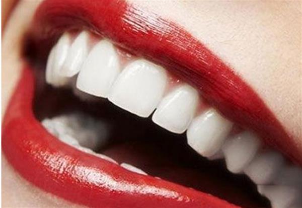 牙齒上有黑斑如何去除