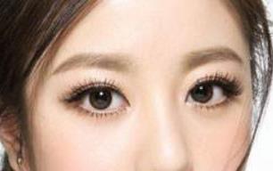 無痕<a href=http://www.f3bb6.cn/listinfo-724-0.html target=_blank class=infotextkey>雙眼皮</a>多久能恢復(fù)