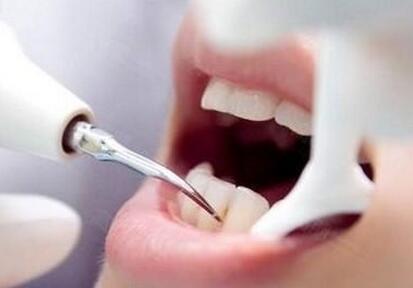 牙菌斑和牙結石有什么區別