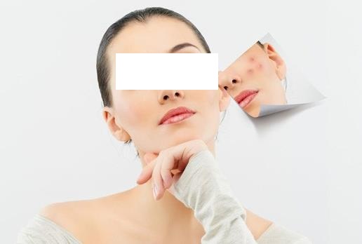 青春痘的臨床表現(xiàn)是怎么樣的