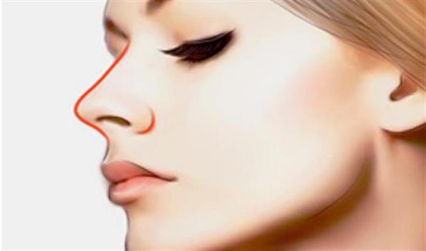 透明質酸打了一年了不消怎么辦