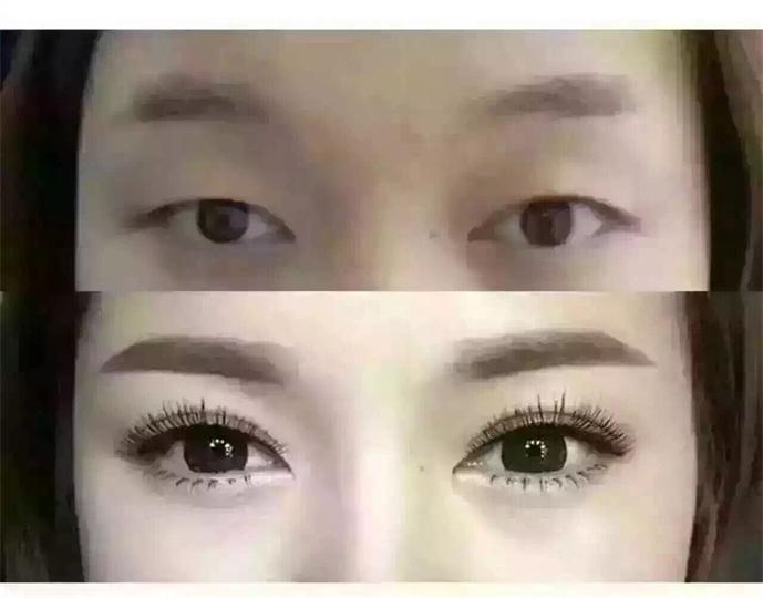 重慶做三點(diǎn)<a href=http://www.f3bb6.cn/listinfo-724-0.html target=_blank class=infotextkey>雙眼皮</a>價(jià)格是多少