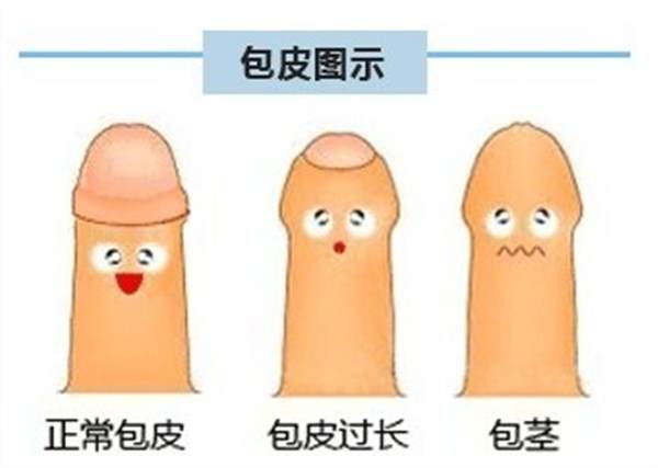 包皮過長有什么危害
