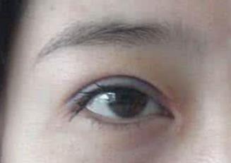 割<a href=http://www.f3bb6.cn/listinfo-724-0.html target=_blank class=infotextkey>雙眼皮</a>可以吃海帶嗎