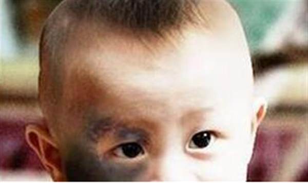 <a href=http://www.f3bb6.cn/listinfo-773-0.html target=_blank class=infotextkey>去胎記</a>大概多少錢