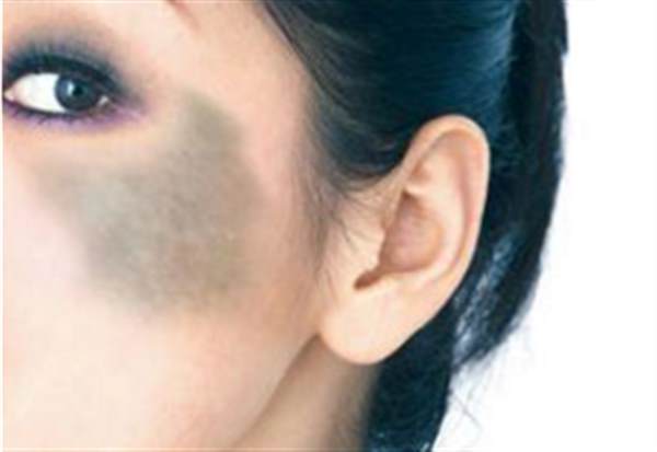 <a href=http://www.f3bb6.cn/listinfo-773-0.html target=_blank class=infotextkey>去胎記</a>價格