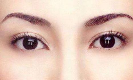 來月經能做<a href=http://www.f3bb6.cn/listinfo-724-0.html target=_blank class=infotextkey>雙眼皮</a>嗎