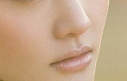 深圳<a href=http://www.f3bb6.cn/listinfo-754-0.html target=_blank class=infotextkey>鼻翼</a>縮小價格是多少