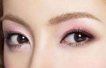 <a href=http://www.f3bb6.cn/listinfo-724-0.html target=_blank class=infotextkey>雙眼皮</a>恢復(fù)時(shí)間