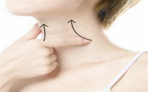 20歲脖子有頸紋怎么辦