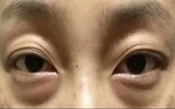 男士<a href=http://www.f3bb6.cn/listinfo-708-0.html target=_blank class=infotextkey>去眼袋</a>較好方法