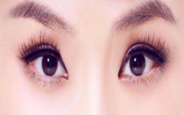 平行歐式<a href=http://www.f3bb6.cn/listinfo-724-0.html target=_blank class=infotextkey>雙眼皮</a>