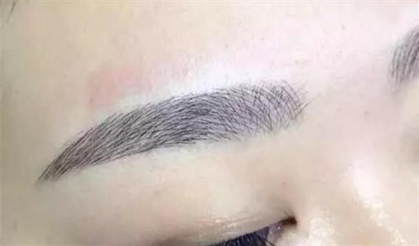 紋眉多少錢幾天掉落