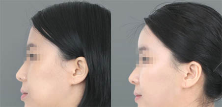 <a href=http://www.f3bb6.cn/listinfo-643-0.html target=_blank class=infotextkey>豐額頭</a>去哪里做比較好