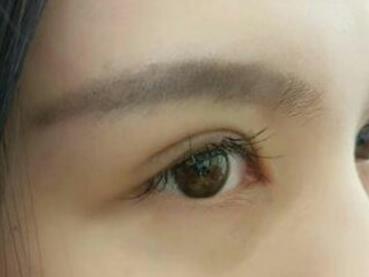 割<a href=http://www.f3bb6.cn/listinfo-724-0.html target=_blank class=infotextkey>雙眼皮</a>多久能長(zhǎng)自然