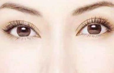 開<a href=http://www.f3bb6.cn/listinfo-724-0.html target=_blank class=infotextkey>雙眼皮</a>多久恢復(fù)