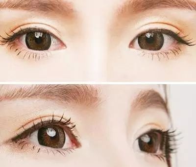 割<a href=http://www.f3bb6.cn/listinfo-724-0.html target=_blank class=infotextkey>雙眼皮</a>類型有哪些