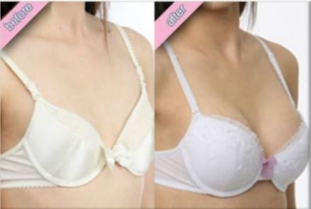 假體<a href=http://www.f3bb6.cn/listinfo-618-0.html target=_blank class=infotextkey>隆胸</a>后影響懷孕嗎