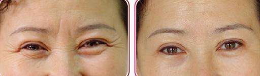 光子<a href=http://www.f3bb6.cn/listinfo-770-0.html target=_blank class=infotextkey>嫩膚</a>多久一次