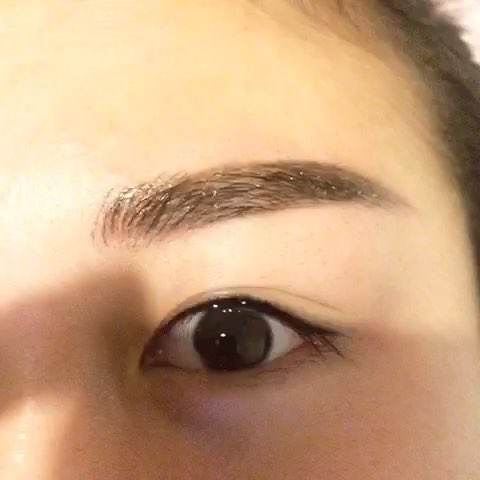 <a href=http://www.f3bb6.cn/listinfo-711-0.html target=_blank class=infotextkey>開眼角</a>留下的疤怎么辦