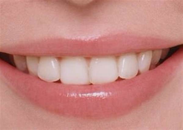 做<a href=http://www.f3bb6.cn/listinfo-824-0.html target=_blank class=infotextkey>牙齒矯正</a>的危害有哪些