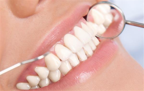 種植牙有什么好處