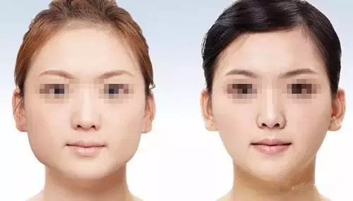 <a href=http://www.f3bb6.cn/listinfo-631-0.html target=_blank class=infotextkey>瘦臉</a><a href=http://www.f3bb6.cn/listinfo-614-0.html target=_blank class=infotextkey>除皺</a>多久效果好