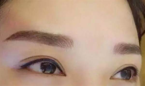 紋眉后碰水了會(huì)怎樣