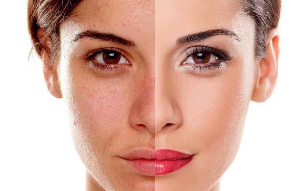 淮南臉部激光<a href=http://www.f3bb6.cn/listinfo-670-0.html target=_blank class=infotextkey>脫毛</a>價格