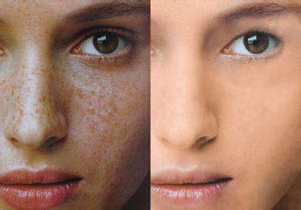 激光點斑每天變化圖片