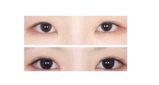 割<a href=http://www.f3bb6.cn/listinfo-724-0.html target=_blank class=infotextkey>雙眼皮</a>手術(shù)的效果好嗎