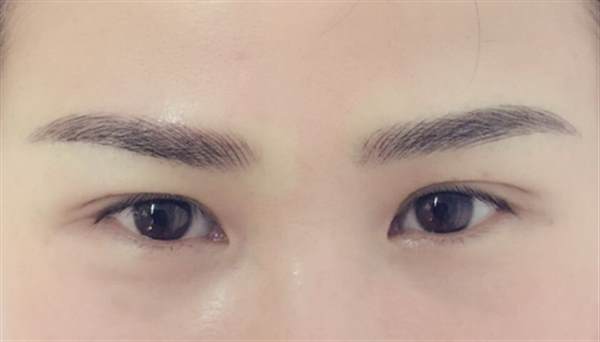 紋眉后過(guò)敏有什么癥狀