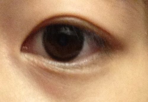 割<a href=http://www.f3bb6.cn/listinfo-724-0.html target=_blank class=infotextkey>雙眼皮</a>價錢高嗎 大概要多少錢