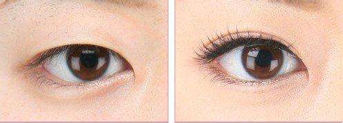 割<a href=http://www.f3bb6.cn/listinfo-724-0.html target=_blank class=infotextkey>雙眼皮</a>的效果持久嗎