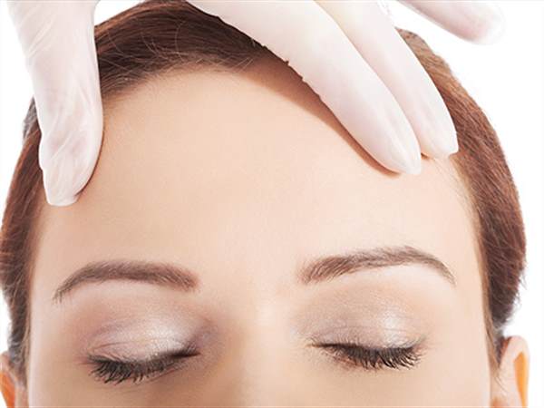 膨體隆額頭多少錢