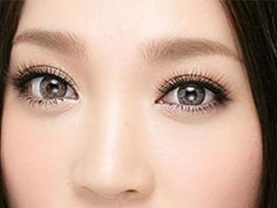 <a href=http://www.f3bb6.cn/listinfo-682-0.html target=_blank class=infotextkey>溶脂</a><a href=http://www.f3bb6.cn/listinfo-708-0.html target=_blank class=infotextkey>去眼袋</a>好不好呢