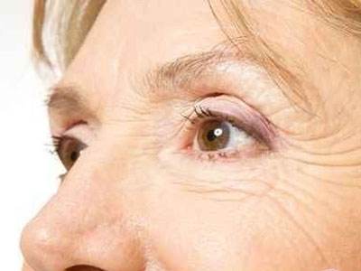 詳解中老年人可以割<a href=http://www.f3bb6.cn/listinfo-724-0.html target=_blank class=infotextkey>雙眼皮</a>嗎？